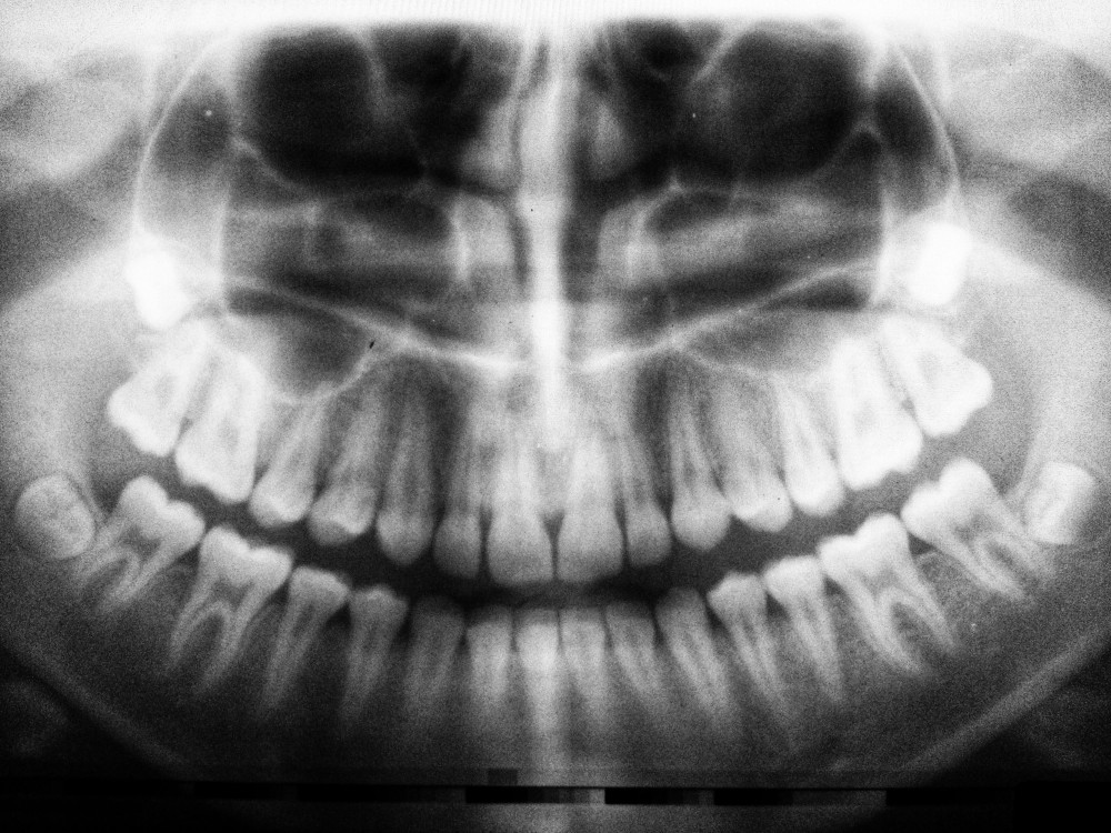 How Much Does An Orthodontist Make in Georgia